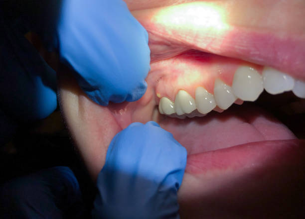 Best Tooth Infection Emergency Dentist  in USA